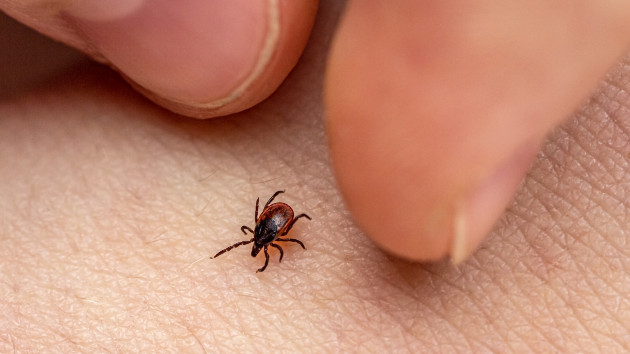 Weekly ER visits for tick bites reach highest level in nearly a decade. Will this season be worse?